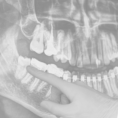 Dental Exams and X-Rays Image